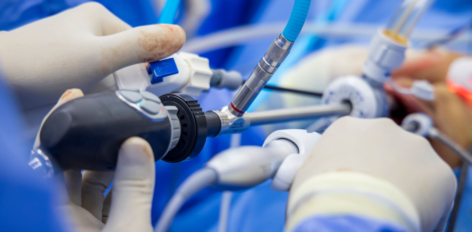 Arthroscopy department at DHS Hospital Ahmedabad